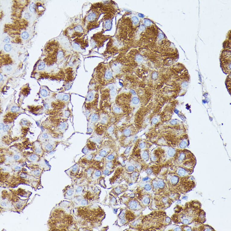 Immunohistochemistry - Anti-PNLIPRP1 Antibody (A305839) - Antibodies.com