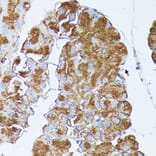 Immunohistochemistry - Anti-PNLIPRP1 Antibody (A305839) - Antibodies.com