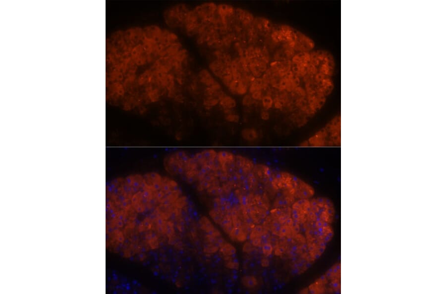 Immunofluorescence - Anti-PNLIPRP1 Antibody (A305839) - Antibodies.com