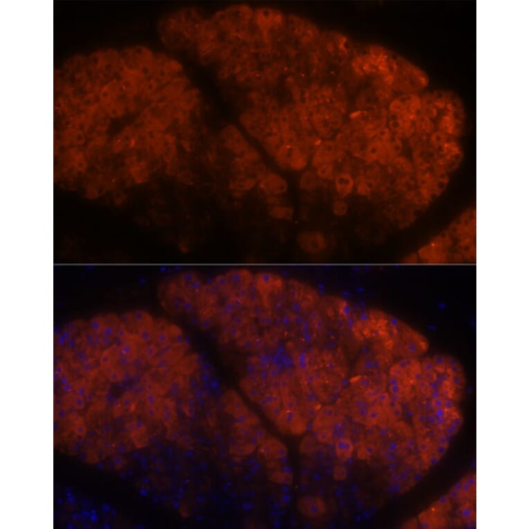 Immunofluorescence - Anti-PNLIPRP1 Antibody (A305839) - Antibodies.com