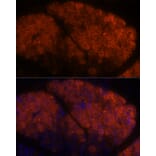 Immunofluorescence - Anti-PNLIPRP1 Antibody (A305839) - Antibodies.com