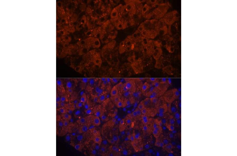 Immunofluorescence - Anti-PNLIPRP1 Antibody (A305839) - Antibodies.com