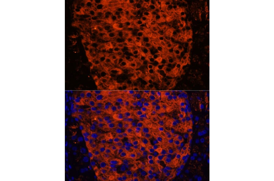Immunofluorescence - Anti-PNLIPRP1 Antibody (A305839) - Antibodies.com