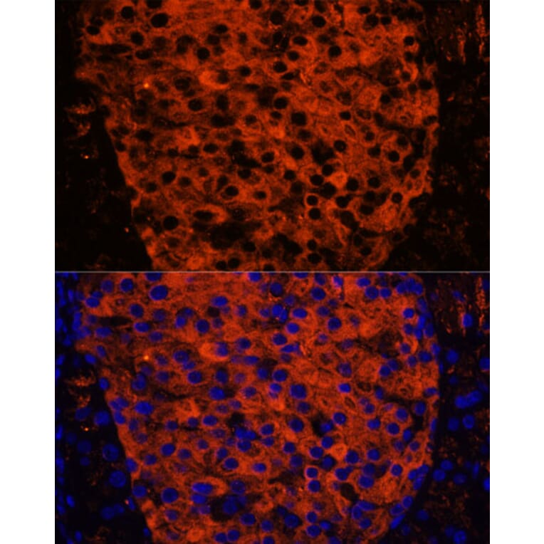 Immunofluorescence - Anti-PNLIPRP1 Antibody (A305839) - Antibodies.com