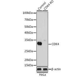 Western Blot - Anti-Cdk4 Antibody (A305840) - Antibodies.com