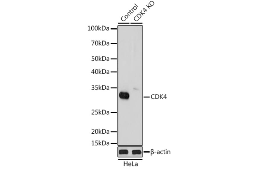 Western Blot - Anti-Cdk4 Antibody (A305840) - Antibodies.com