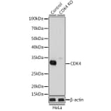 Western Blot - Anti-Cdk4 Antibody (A305840) - Antibodies.com