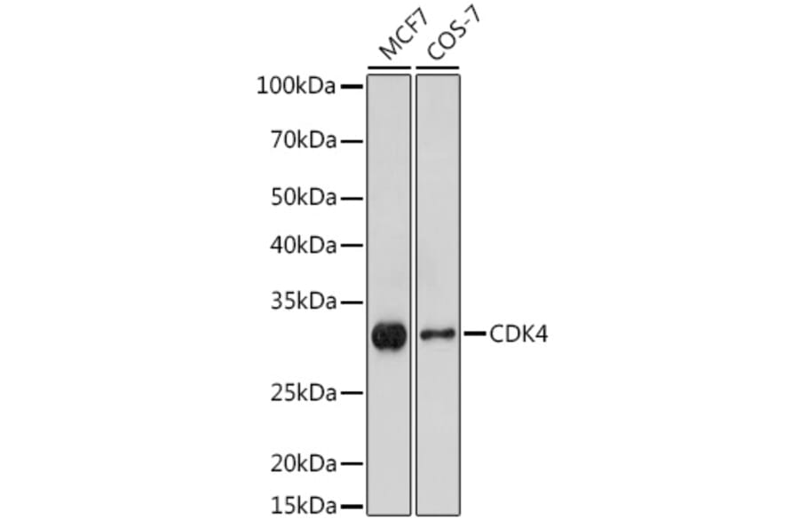 Western Blot - Anti-Cdk4 Antibody (A305840) - Antibodies.com