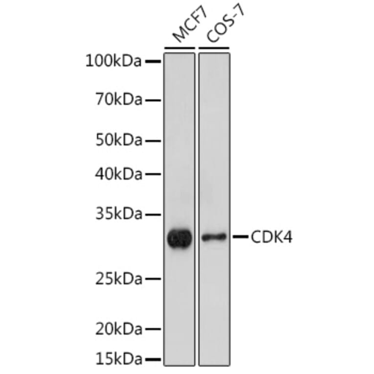 Western Blot - Anti-Cdk4 Antibody (A305840) - Antibodies.com