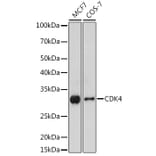 Western Blot - Anti-Cdk4 Antibody (A305840) - Antibodies.com