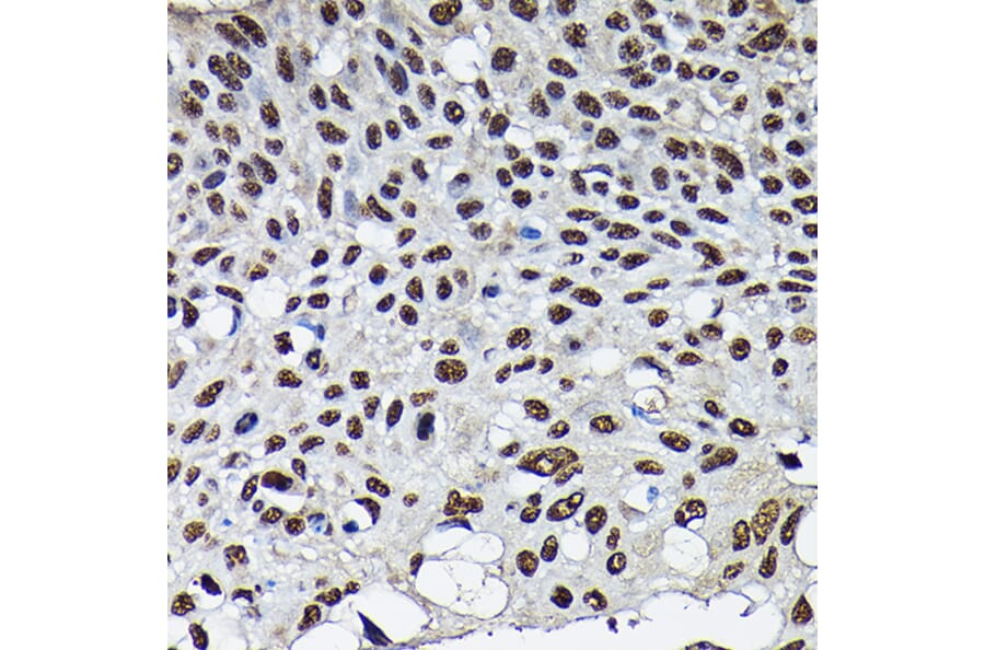 Immunohistochemistry - Anti-Cdk4 Antibody (A305840) - Antibodies.com