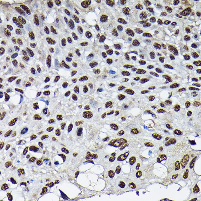 Immunohistochemistry - Anti-Cdk4 Antibody (A305840) - Antibodies.com