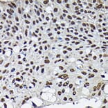 Immunohistochemistry - Anti-Cdk4 Antibody (A305840) - Antibodies.com