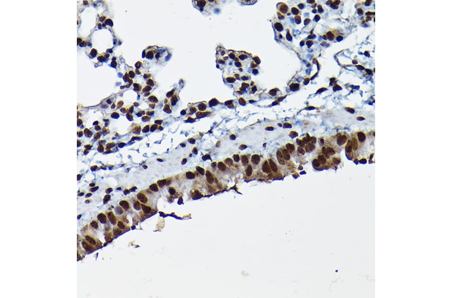 Immunohistochemistry - Anti-Cdk4 Antibody (A305840) - Antibodies.com