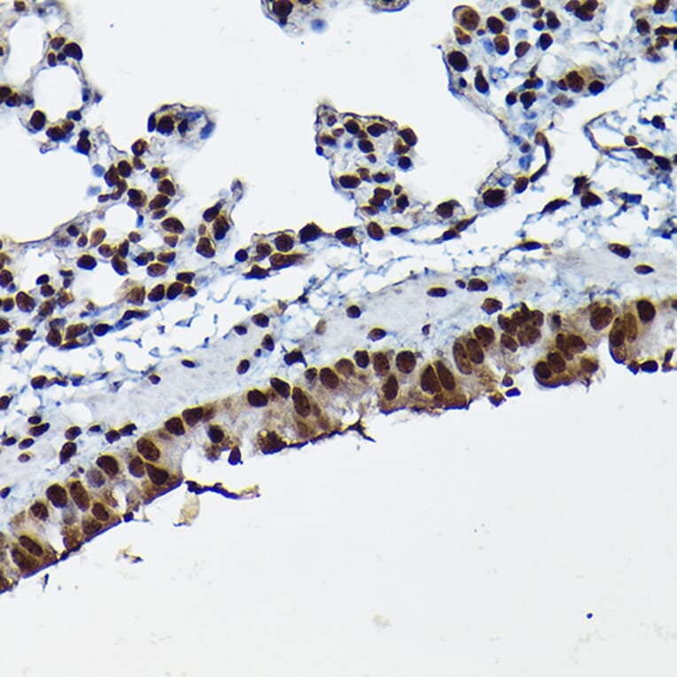 Immunohistochemistry - Anti-Cdk4 Antibody (A305840) - Antibodies.com