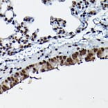 Immunohistochemistry - Anti-Cdk4 Antibody (A305840) - Antibodies.com
