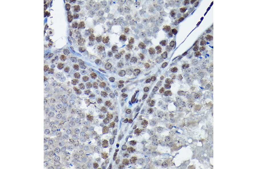 Immunohistochemistry - Anti-Cdk4 Antibody (A305840) - Antibodies.com