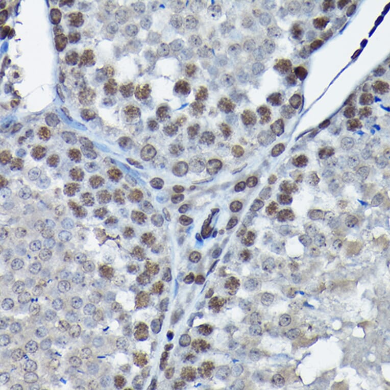 Immunohistochemistry - Anti-Cdk4 Antibody (A305840) - Antibodies.com