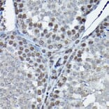 Immunohistochemistry - Anti-Cdk4 Antibody (A305840) - Antibodies.com