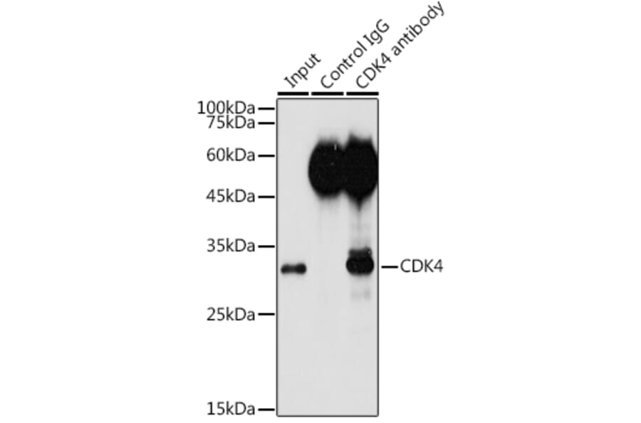 Western Blot - Anti-Cdk4 Antibody (A305840) - Antibodies.com