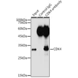 Western Blot - Anti-Cdk4 Antibody (A305840) - Antibodies.com