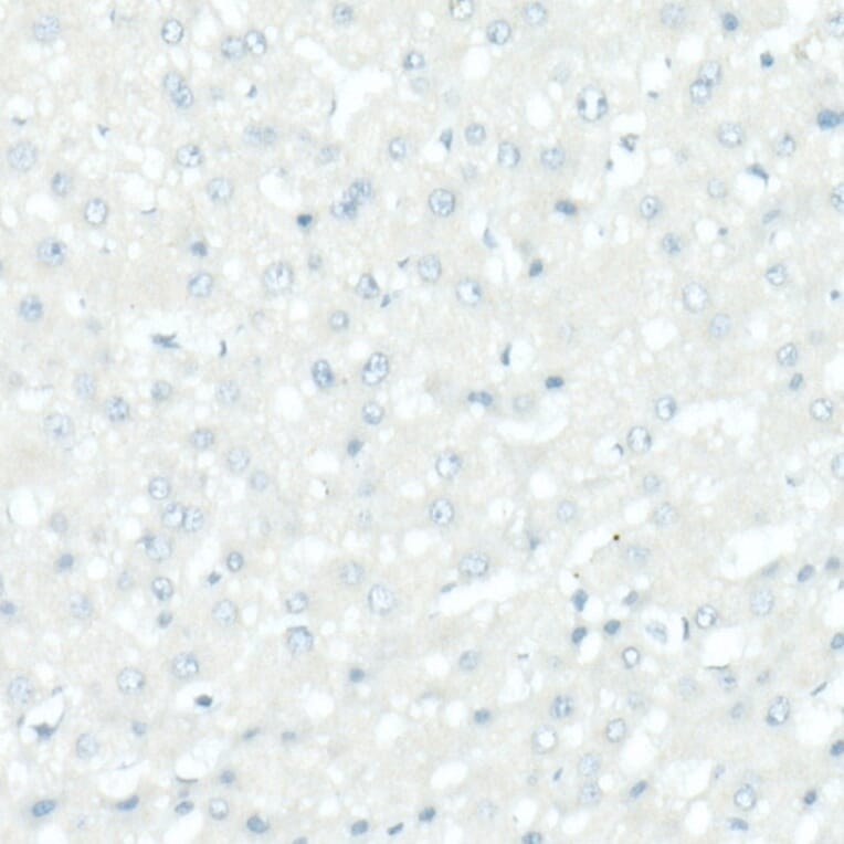 Immunohistochemistry - Anti-Tyrosinase Antibody [ARC53165] (A305841) - Antibodies.com