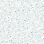 Immunohistochemistry - Anti-Tyrosinase Antibody [ARC53165] (A305841) - Antibodies.com