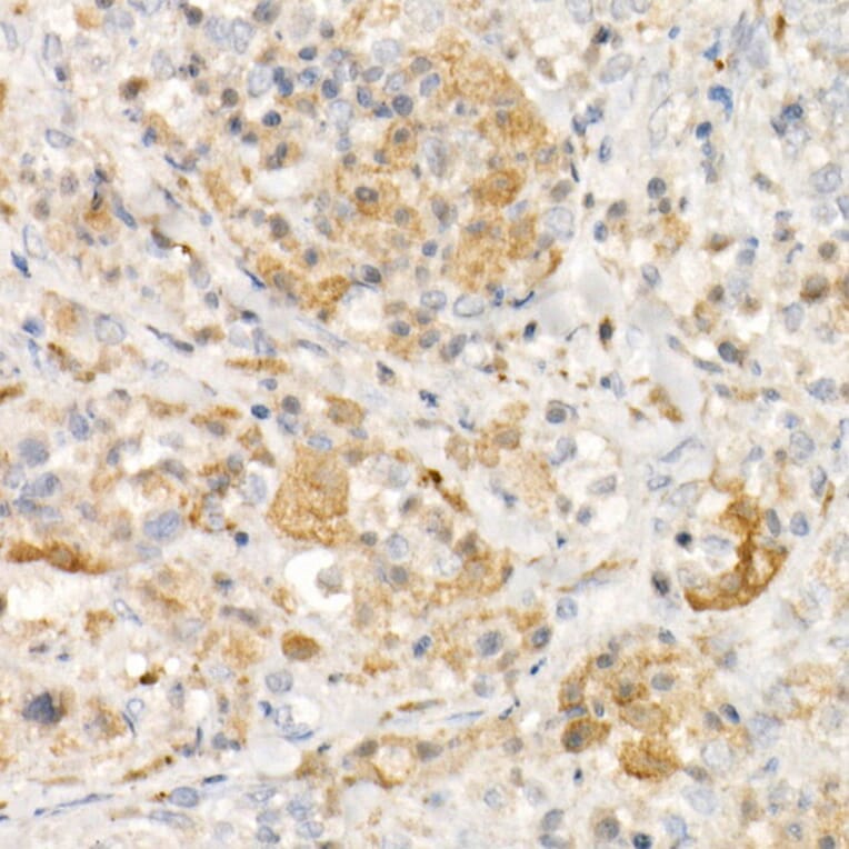 Immunohistochemistry - Anti-Tyrosinase Antibody [ARC53165] (A305841) - Antibodies.com