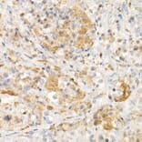 Immunohistochemistry - Anti-Tyrosinase Antibody [ARC53165] (A305841) - Antibodies.com