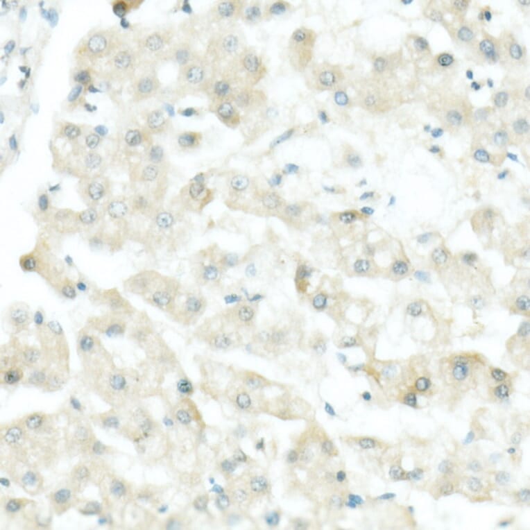 Immunohistochemistry - Anti-Tyrosinase Antibody [ARC53166] (A305842) - Antibodies.com