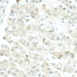 Immunohistochemistry - Anti-Tyrosinase Antibody [ARC53166] (A305842) - Antibodies.com