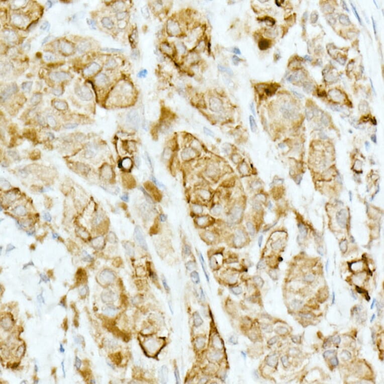 Immunohistochemistry - Anti-Tyrosinase Antibody [ARC53166] (A305842) - Antibodies.com