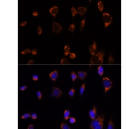 Immunofluorescence - Anti-PDHA1 Antibody (A305843) - Antibodies.com