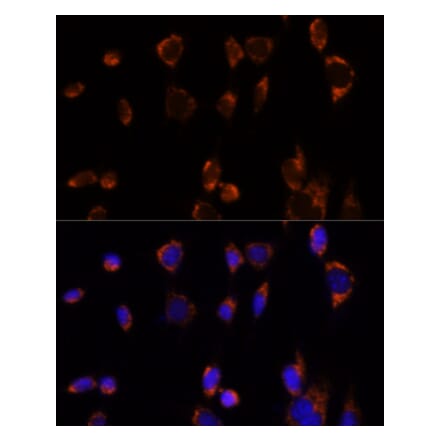 Immunofluorescence - Anti-PDHA1 Antibody (A305843) - Antibodies.com