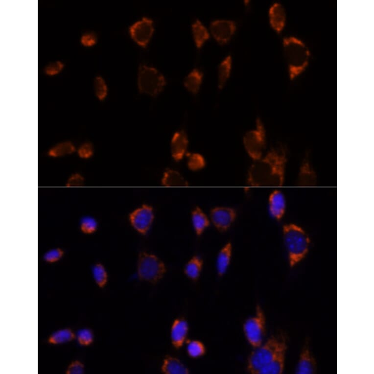 Immunofluorescence - Anti-PDHA1 Antibody (A305843) - Antibodies.com