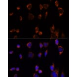 Immunofluorescence - Anti-PDHA1 Antibody (A305843) - Antibodies.com