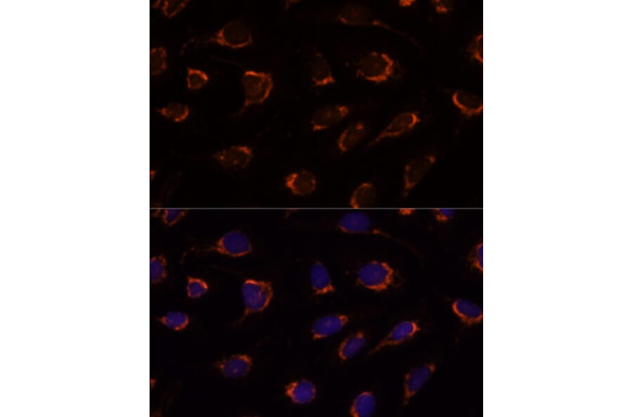 Immunofluorescence - Anti-PDHA1 Antibody (A305843) - Antibodies.com