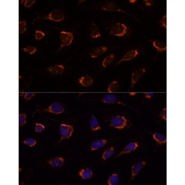 Immunofluorescence - Anti-PDHA1 Antibody (A305843) - Antibodies.com