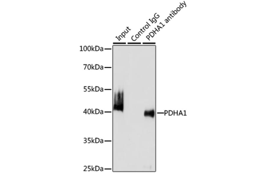 Western Blot - Anti-PDHA1 Antibody (A305843) - Antibodies.com