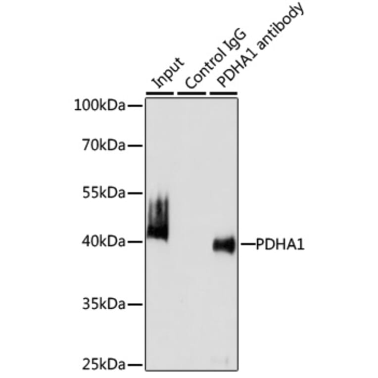 Western Blot - Anti-PDHA1 Antibody (A305843) - Antibodies.com