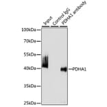 Western Blot - Anti-PDHA1 Antibody (A305843) - Antibodies.com