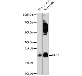 Western Blot - Anti-Hes1 Antibody [ARC0513] (A305844) - Antibodies.com