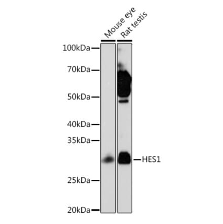 Western Blot - Anti-Hes1 Antibody [ARC0513] (A305844) - Antibodies.com