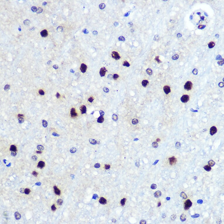 Immunohistochemistry - Anti-Hes1 Antibody [ARC0513] (A305844) - Antibodies.com