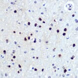 Immunohistochemistry - Anti-Hes1 Antibody [ARC0513] (A305844) - Antibodies.com