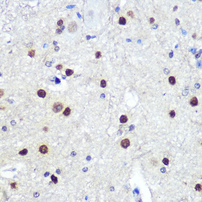 Immunohistochemistry - Anti-Hes1 Antibody [ARC0513] (A305844) - Antibodies.com