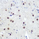 Immunohistochemistry - Anti-Hes1 Antibody [ARC0513] (A305844) - Antibodies.com
