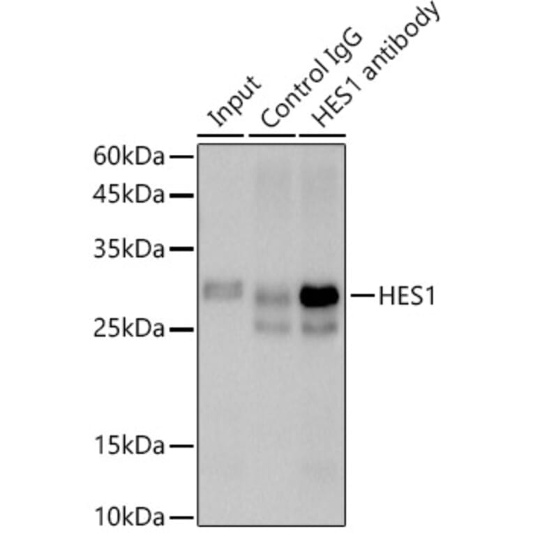 Western Blot - Anti-Hes1 Antibody [ARC0513] (A305844) - Antibodies.com