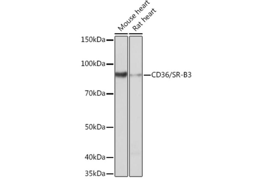 Western Blot - Anti-CD36 Antibody [ARC0461] (A305845) - Antibodies.com