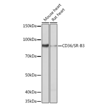 Western Blot - Anti-CD36 Antibody [ARC0461] (A305845) - Antibodies.com